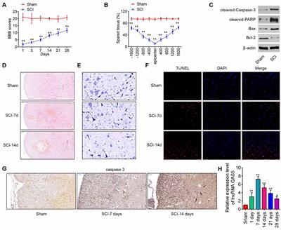 Silencing of Long Noncoding RNA Growth Arrest–Specific 5 Alleviates Neuronal Cell Apoptosis and Inflammatory Responses Through Sponging microRNA-93 to Repress PTEN Expression in Spinal Cord Injury